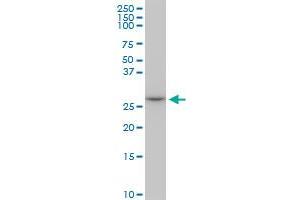Western Blotting (WB) image for anti-Melanoma Antigen Family A, 12 (MAGEA12) (AA 70-168) antibody (ABIN517711)