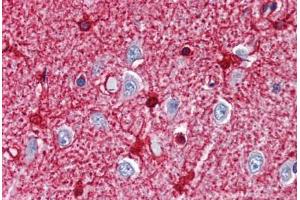 Human Brain, Cortex (formalin-fixed, paraffin-embedded) stained with GLUL antibody ABIN337301 at 10 ug/ml followed by biotinylated anti-mouse IgG secondary antibody ABIN481714, alkaline phosphatase-streptavidin and chromogen. (GLUL 抗体)
