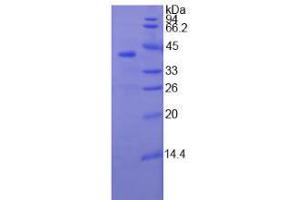 SDS-PAGE analysis of Human TNNT1 Protein. (TNNT1 蛋白)