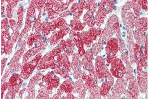 Human Rabbit Heart (formalin-fixed, paraffin-embedded) stained with TNNT2 antibody ABIN462337 followed by biotinylated anti-mouse IgG secondary antibody ABIN481714, alkaline phosphatase-streptavidin and chromogen. (Cardiac Troponin T2 抗体  (Exon 10))