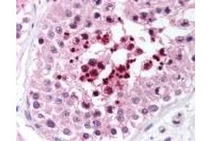 Immunohistochemistry (IHC) image for anti-RAP1 Interacting Factor Homolog (RIF1) (AA 2406-2419) antibody (ABIN2469662) (RIF1 抗体  (AA 2406-2419))