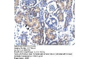 Immunohistochemistry (IHC) image for anti-Proteasome (Prosome, Macropain) 26S Subunit, ATPase, 3 (PSMC3) (Middle Region) antibody (ABIN2777668)