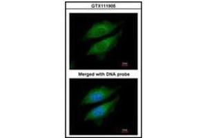Immunofluorescence analysis of paraformaldehyde-fixed HeLa, using DPRP1 antibody at 1/200 dilution. (DPP8 抗体)