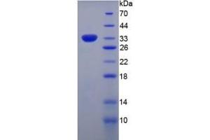 SDS-PAGE (SDS) image for Collagen, Type VII, alpha 1 (COL7A1) ELISA Kit (ABIN6730965)