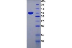 SDS-PAGE of Protein Standard from the Kit  (Highly purified E. (COL7 ELISA 试剂盒)
