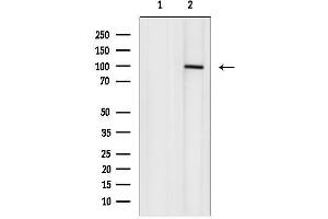 anti-ADAM Metallopeptidase Domain 12 (ADAM12) (N-Term) antibody
