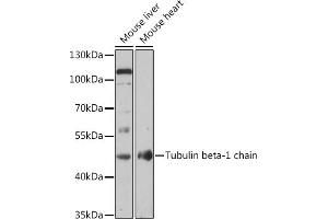 Western blot analysis of extracts of various cell lines, using Tubulin beta-1 chain antibody (ABIN7271046) at 1:1000 dilution. (TUBB1 抗体  (AA 362-451))