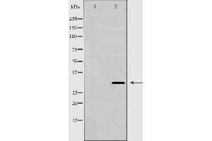 Western blot analysis of extracts of Mouse brain tissue lysate, using GJB3 antibody. (Connexin 31 抗体  (C-Term))
