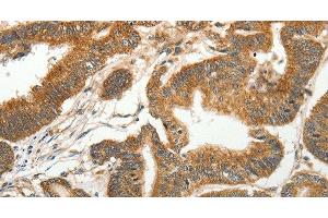 Immunohistochemistry (Paraffin-embedded Sections) (IHC (p)) image for anti-Solute Carrier Family 4, Sodium Bicarbonate Cotransporter, Member 4 (SLC4A4) antibody (ABIN7235532)