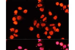 Immunofluorescence analysis of HeLa cells using XRCC1 Polyclonal Antibody at dilution of 1:100 (40x lens). (XRCC1 抗体)