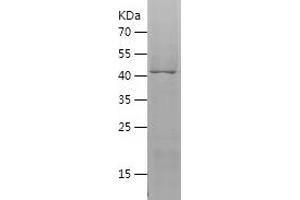 Western Blotting (WB) image for Vanin 2 (VNN2) (AA 279-492) protein (His-IF2DI Tag) (ABIN7125697) (VNN2 Protein (AA 279-492) (His-IF2DI Tag))