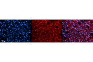 Rabbit Anti-LBP Antibody   Formalin Fixed Paraffin Embedded Tissue: Human Liver Tissue Observed Staining: Cytoplasm and plasma membrane in endothelial cells in sinusoids Primary Antibody Concentration: 1:100 Other Working Concentrations: 1:600 Secondary Antibody: Donkey anti-Rabbit-Cy3 Secondary Antibody Concentration: 1:200 Magnification: 20X Exposure Time: 0. (LBP 抗体  (C-Term))