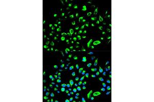 Immunofluorescence analysis of HeLa cell using YWHAQ antibody. (14-3-3 theta 抗体  (AA 1-245))
