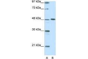 WB Suggested Anti-ZNF259 Antibody Titration:  0. (ZNF259 抗体  (C-Term))