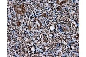 Immunohistochemical staining of paraffin-embedded Kidney tissue using anti-MCL1 mouse monoclonal antibody. (MCL-1 抗体)