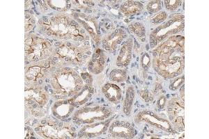 ABIN6266622 at 1/100 staining human kidney tissue sections by IHC-P. (PDGFRA 抗体  (Internal Region))