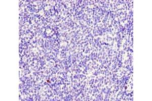 Immunohistochemistry of paraffin-embedded human lymph node tissue using ABIN7174949 at dilution of 1:100 (MYO1G 抗体  (AA 209-389))