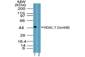 Image no. 1 for anti-Histone Deacetylase 7 (HDAC7) (AA 443-452) antibody (ABIN960196) (HDAC7 抗体  (AA 443-452))