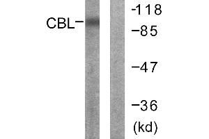 Immunohistochemistry analysis of paraffin-embedded human breast carcinoma tissue using CBL (Ab-700) antibody. (CBL 抗体  (Tyr700))