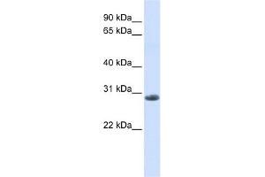 YIPF6 antibody used at 1 ug/ml to detect target protein. (YIPF6 抗体  (C-Term))