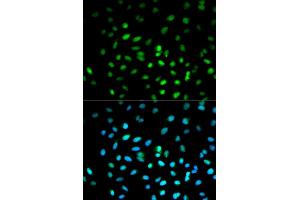 Immunofluorescence analysis of MCF-7 cells using STK11 antibody. (LKB1 抗体)