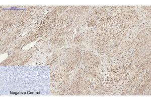 Immunohistochemical analysis of paraffin-embedded human uterus tissue.