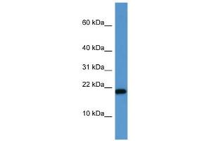 WB Suggested Anti-SH2D1A Antibody Titration: 0. (SH2D1A 抗体  (C-Term))