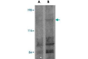Western blot analysis of FRMPD1 in K-562 cell lysate with FRMPD1 polyclonal antibody  at (A) 1 and (B) 2 ug/mL .