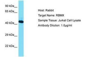 Image no. 1 for anti-RNA Binding Motif Protein, X-Linked (RBMX) (AA 210-259) antibody (ABIN6750464) (RBMX 抗体  (AA 210-259))