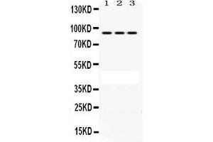 Anti-PRLR Picoband antibody, Western blotting All lanes: Anti PRLR  at 0. (Prolactin Receptor 抗体  (C-Term))
