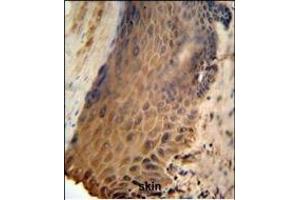 GFPT2 Antibody (Center) (ABIN653230 and ABIN2842763) IHC analysis in formalin fixed and paraffin embedded human skin followed by peroxidase conjugation of the secondary antibody and DAB staining. (GFPT2 抗体  (AA 175-201))