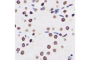 Immunohistochemical analysis of FIR staining in human kidney formalin fixed paraffin embedded tissue section. (FARP2 抗体)