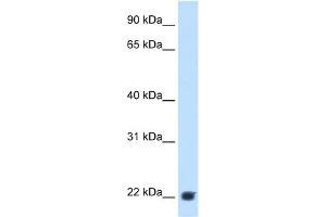 WB Suggested Anti-KLKB1 Antibody Titration:  2. (KLKB1 抗体  (Middle Region))