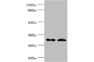 Western blot All lanes: ZWINT antibody at 8. (ZWINT 抗体  (AA 1-277))