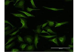 Immunofluorescence of monoclonal antibody to MAGEA3 on HeLa cell. (MAGEA3 抗体  (AA 44-114))