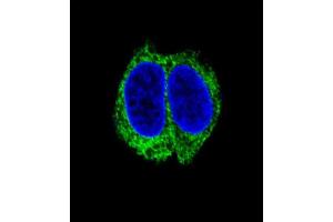 Immunofluorescence (IF) image for anti-Transforming Growth Factor, beta Receptor II (70/80kDa) (TGFBR2) (AA 20-48), (N-Term) antibody (ABIN955177)