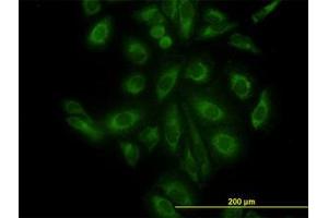 Image no. 3 for anti-ARP3 Actin-Related Protein 3 (ACTR3) (AA 1-419) antibody (ABIN599115) (ACTR3 抗体  (AA 1-419))