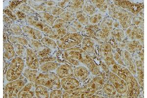 ABIN6272989 at 1/100 staining Mouse kidney tissue by IHC-P. (CAPZA1 抗体  (Internal Region))