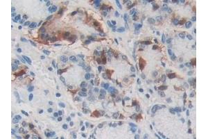 Immunohistochemistry (IHC) image for anti-Secretagogin, EF-Hand Calcium Binding Protein (SCGN) (AA 1-276) antibody (ABIN7436363)