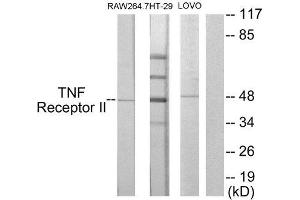 Western Blotting (WB) image for anti-Tumor Necrosis Factor Receptor Superfamily, Member 1B (TNFRSF1B) (C-Term) antibody (ABIN1849234) (TNFRSF1B 抗体  (C-Term))