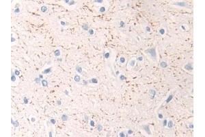 Detection of MAP2K1 in Human Cerebrum Tissue using Polyclonal Antibody to Mitogen Activated Protein Kinase Kinase 1 (MAP2K1) (MEK1 抗体  (AA 54-369))