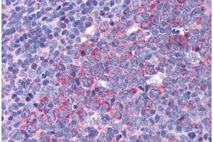 Immunohistochemistry (IHC) image for anti-Eukaryotic Translation Initiation Factor 5A (EIF5A) (Internal Region) antibody (ABIN571047)
