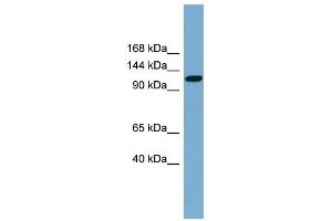 SLC12A5 antibody used at 1 ug/ml to detect target protein. (KCC2 抗体)