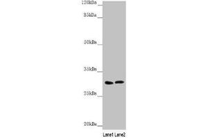 Western blot All lanes: SNAP29 antibody at 1. (SNAP29 抗体  (AA 1-258))
