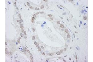 Immunohistochemistry (IHC) image for anti-DEAD (Asp-Glu-Ala-Asp) Box Polypeptide 24 (DDX24) (C-Term) antibody (ABIN7448518) (DDX24 抗体  (C-Term))