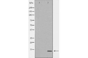 Western blot analysis of JAR  lysate using CGA antibody. (CGA 抗体  (Internal Region))