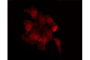 ABIN6267374 staining 293 by IF/ICC. (Src 抗体  (pTyr419))