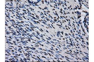 Immunohistochemical staining of paraffin-embedded colon tissue using anti-RPA2 mouse monoclonal antibody. (RPA2 抗体)
