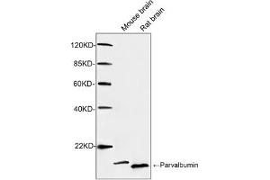 Western blot analysis of tissue lysates using 1 µg/mL Rabbit Anti-Parvalbumin Polyclonal Antibody (ABIN398923) The signal was developed with IRDye-800 Conjugated Goat Anti-Rabbit IgG. (PVALB 抗体)