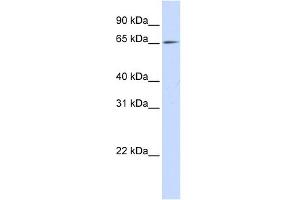 WB Suggested Anti-NET1 Antibody Titration: 0. (NET1 抗体  (N-Term))